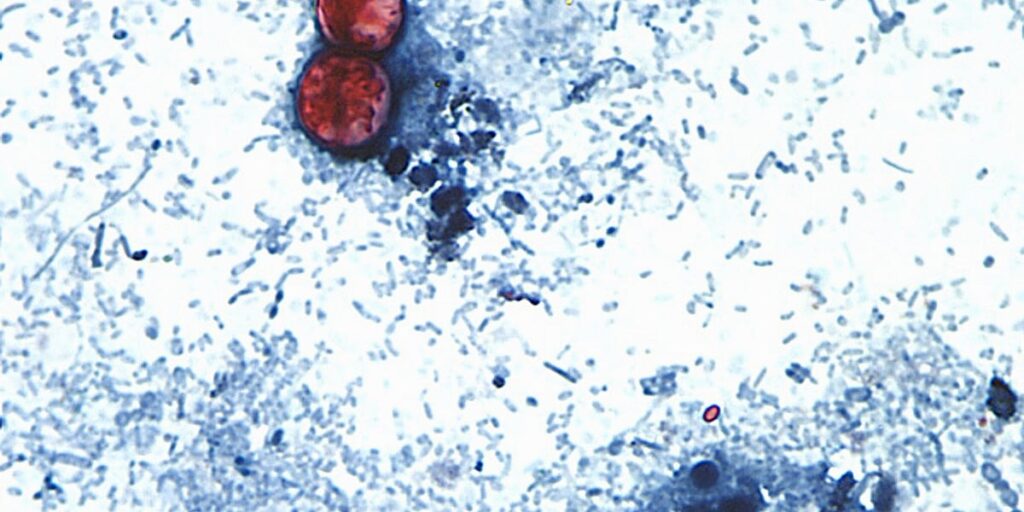 Ciklospora u iceberg salati izazvala epidemiju u 15 američkih saveznih država